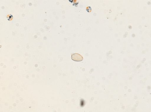 Paragonimus westermani