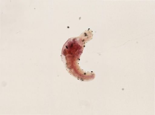 Chaetogaster limnaei