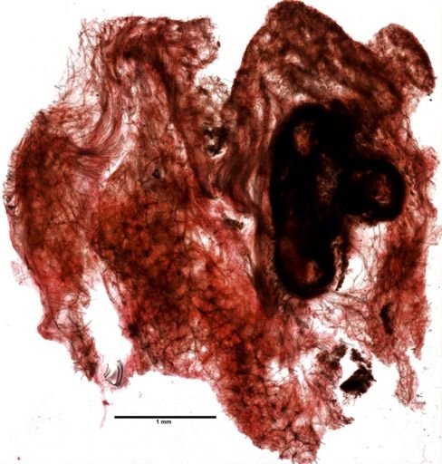 Lissodendoryx isodictyalis
