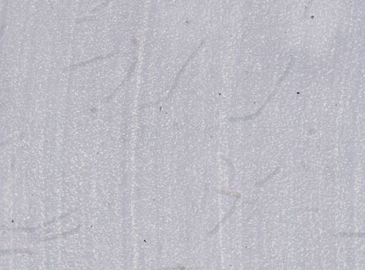 Trypanosoma equiperdum