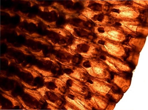 Watersipora nigra