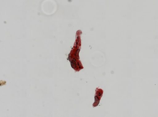 Trematoda