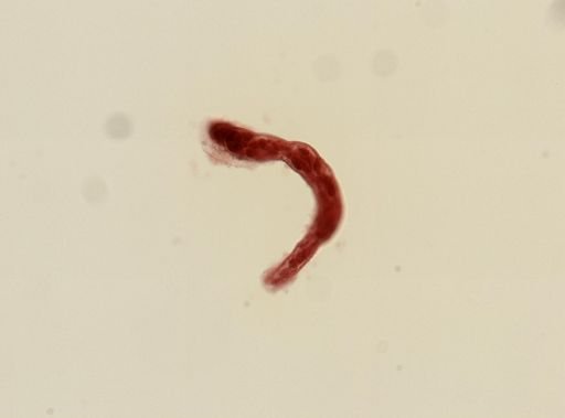 Digenea