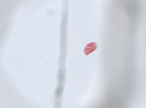 Woodruffia metabolica