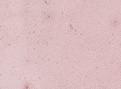 Plasmodium vivax