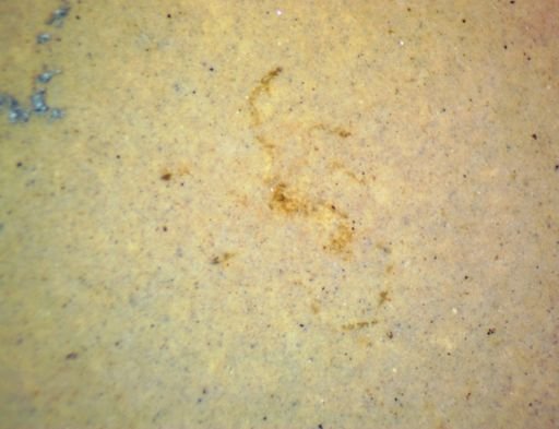undet. Araneae