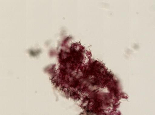Haliclona sp.