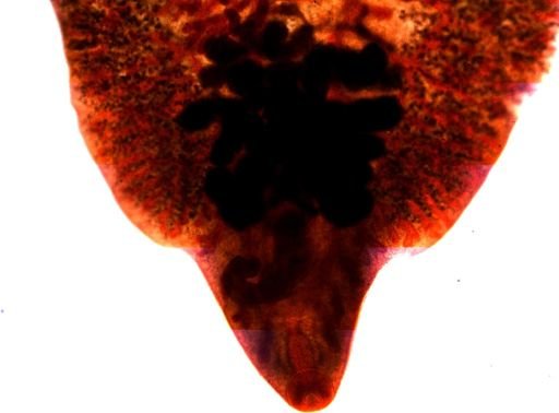 Fasciola hepatica