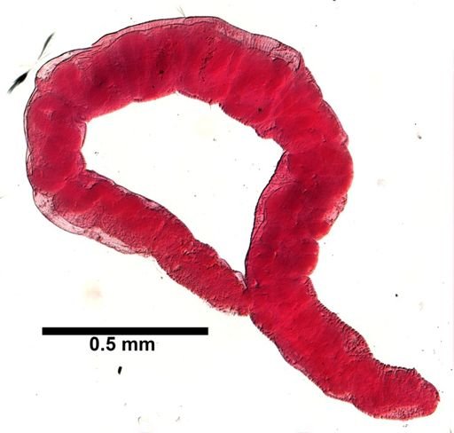 Limnodriloides medioporus