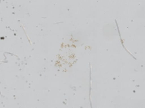 Somatogyrus obtusus