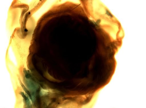 Taenia solium