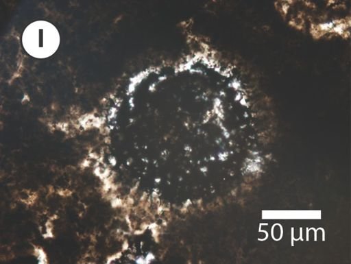 Variomargosphaeridium aculeiparvum