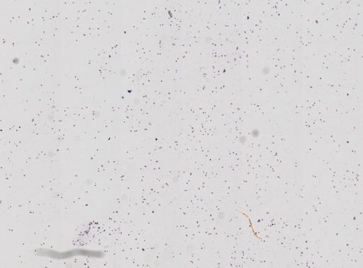 Toxoplasma
