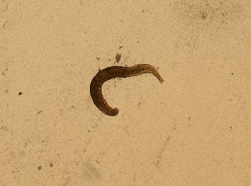 Enterobius vermicularis