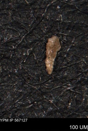 Verneuilina canadensis