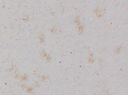 Plakortis sp.