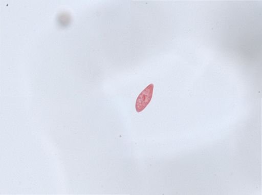 Paramecium aurelia