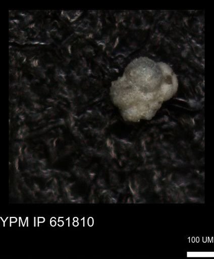 undet. Rugoglobigerinidae