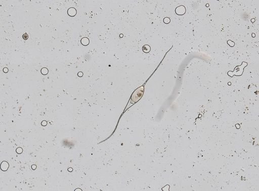 Filinia terminalis
