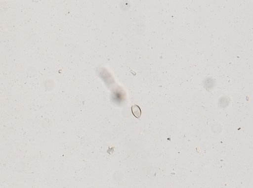 Trichuris vulpis
