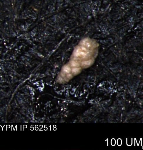 Verneuilina canadensis