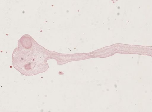 Taenia solium