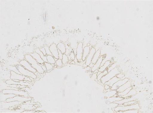 Sycon sp.
