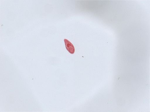 Paramecium aurelia