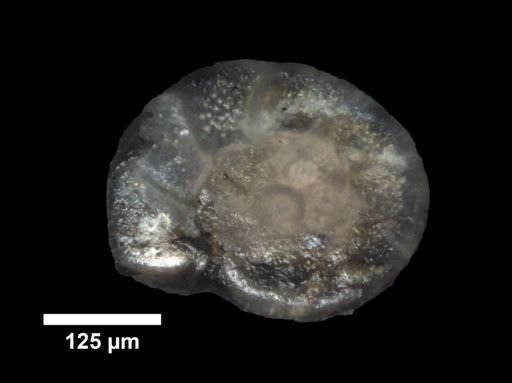 Cibicides primulus