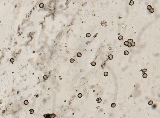 Taenia solium