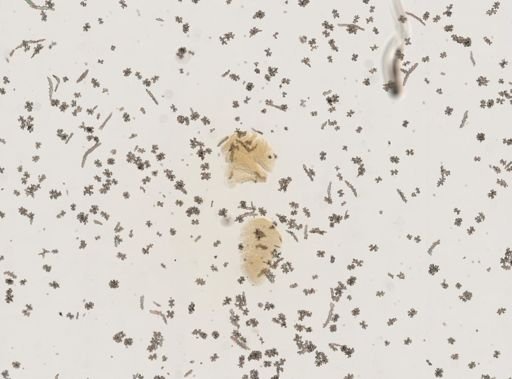 Gersemia fruticosa