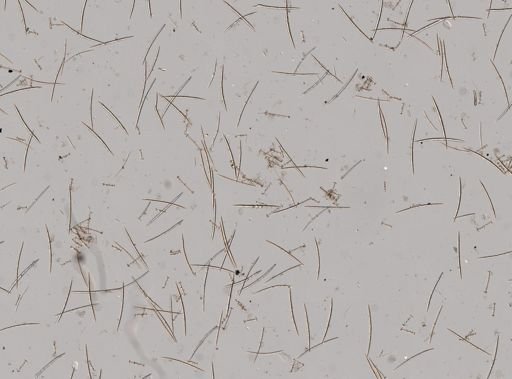 Anheteromeyenia argyrosperma