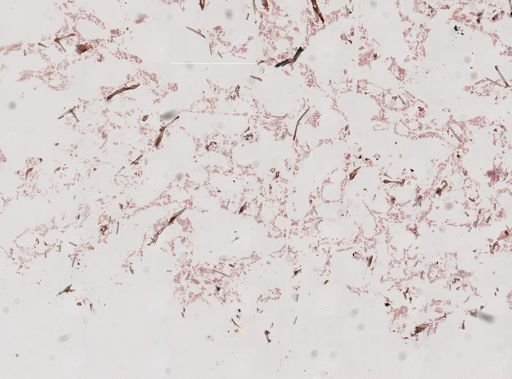 Haliclona oculata