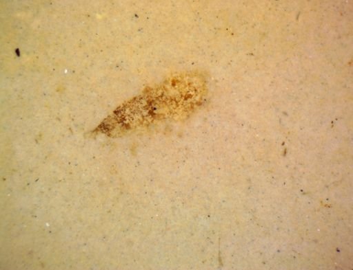 undet. Hexapoda