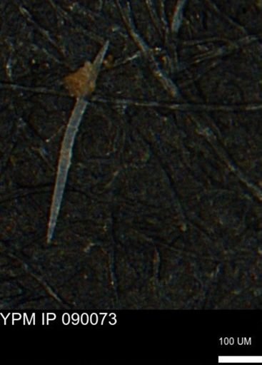 undet. Porifera