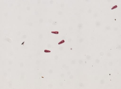Fasciola hepatica