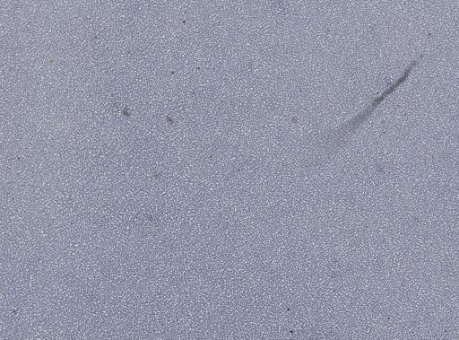 Plasmodium vivax