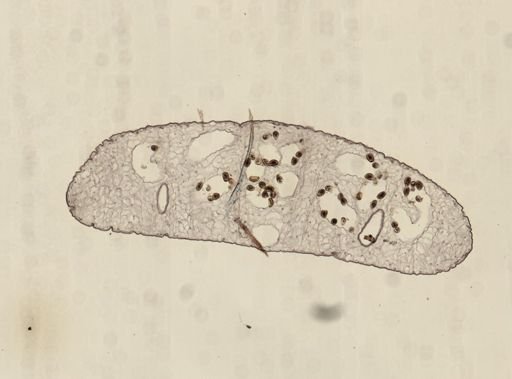 Dicrocoelium dendriticum
