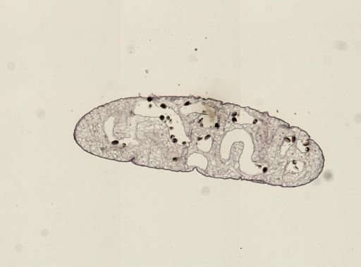 Dicrocoelium dendriticum