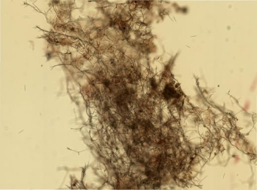 Chalinula loosanoffi
