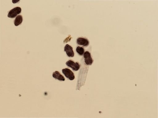 Polycladida