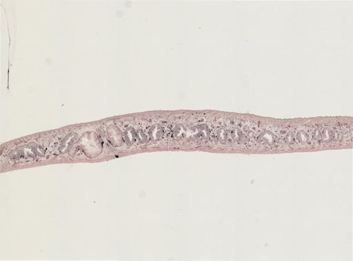 Turbellaria