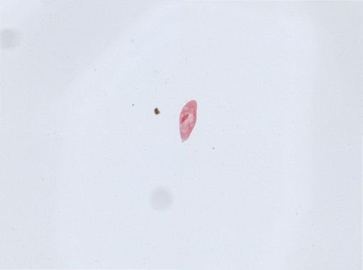 Paramecium aurelia