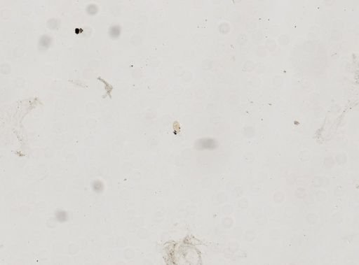 Paramecium polycaryum