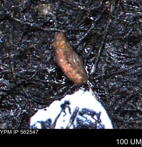 Foraminiferida?