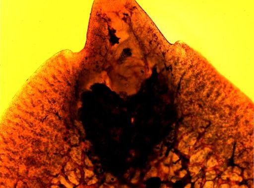 Fasciola hepatica