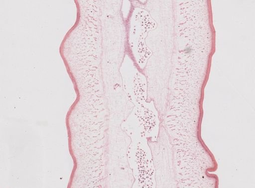 Taenia saginata