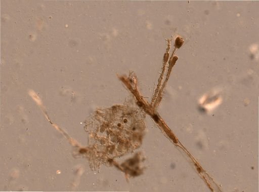 Bryozoa