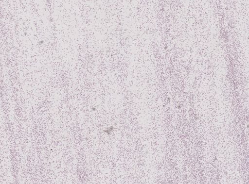 Plasmodium cathemerium