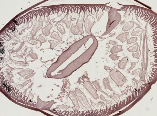 Ascaris lumbricoides